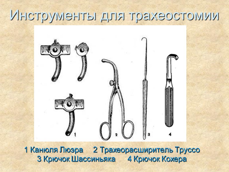 Инструменты для трахеостомии 1 Канюля Люэра     2 Трахеорасширитель Труссо 3